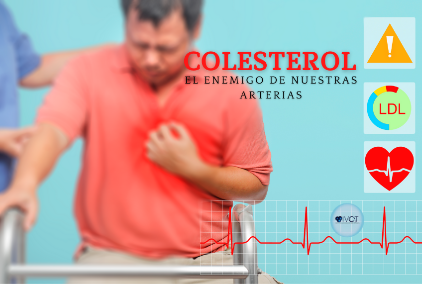 En este momento estás viendo Colesterol oxidado, enemigo de nuestras arterias