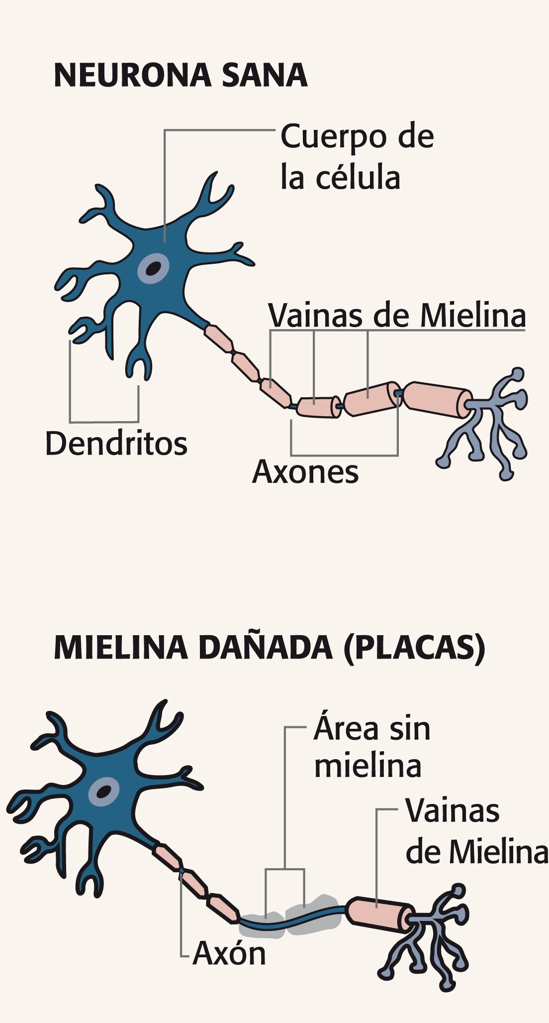 regeneración de la mielina