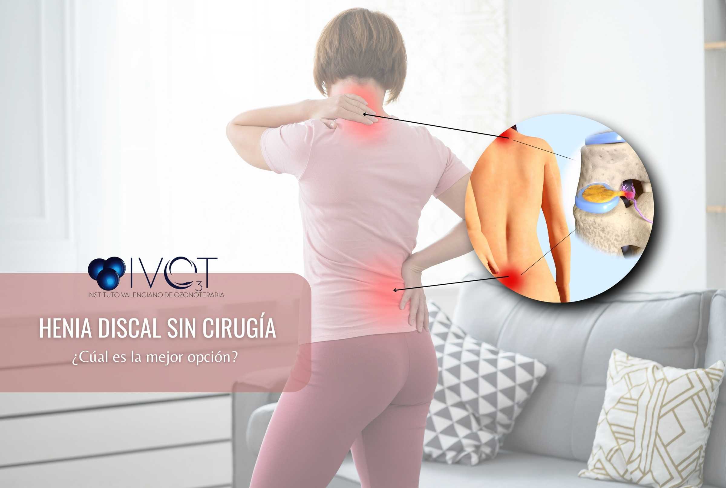hernia discal sin cirugía