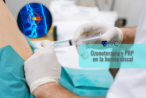 Ozonoterapia y PRP en la Hernia discal