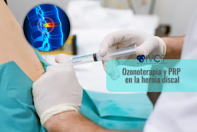 Tratamiento de ozonoterapia y PRP para dolor lumbar y hernia discal